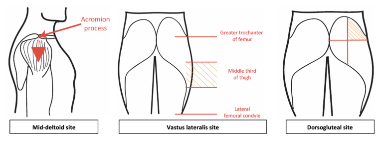 Intramuscular Injection Oscestop Osce Learning