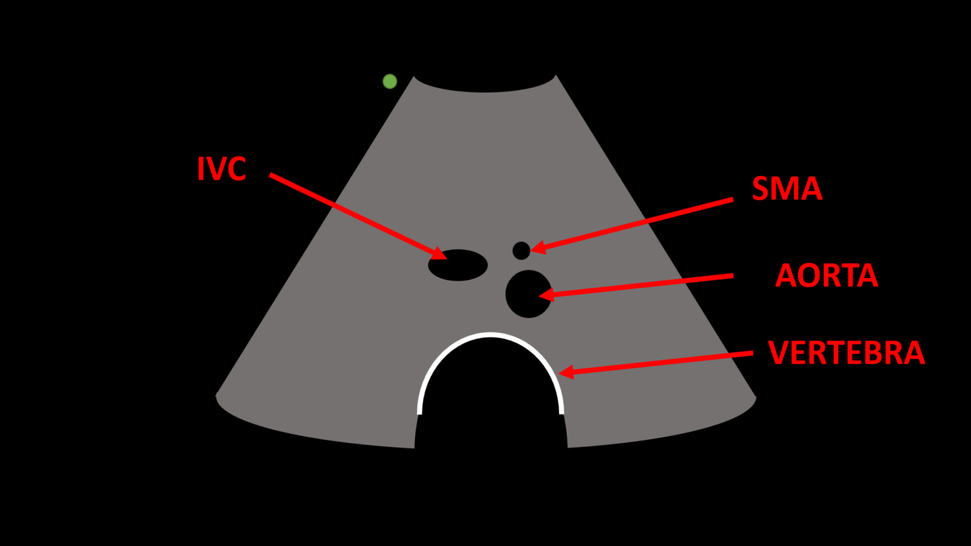 Ultrasound Scanning Basics Advanced OSCEstop OSCE Learning