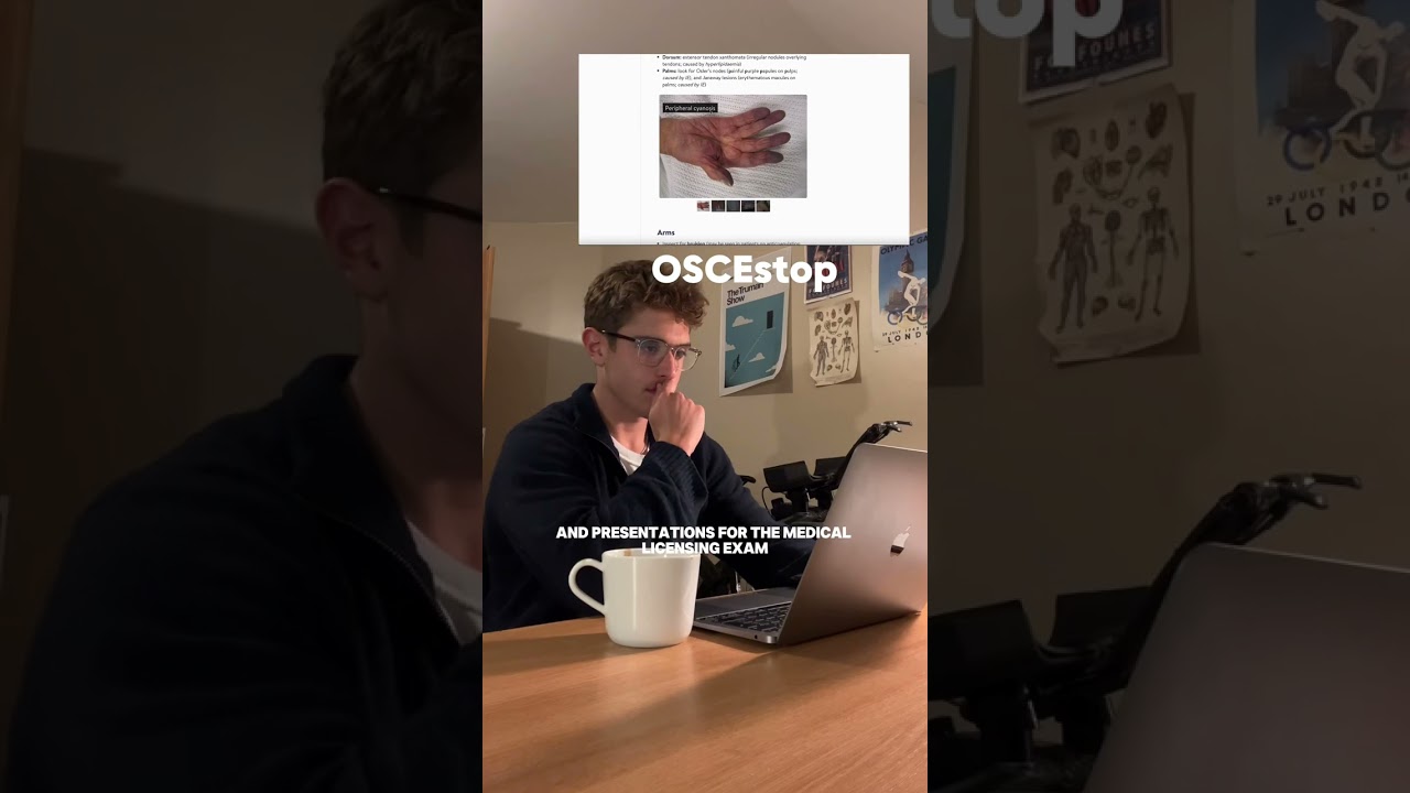 YouTube Short - Matt Kaminer (OSCEstop student)
