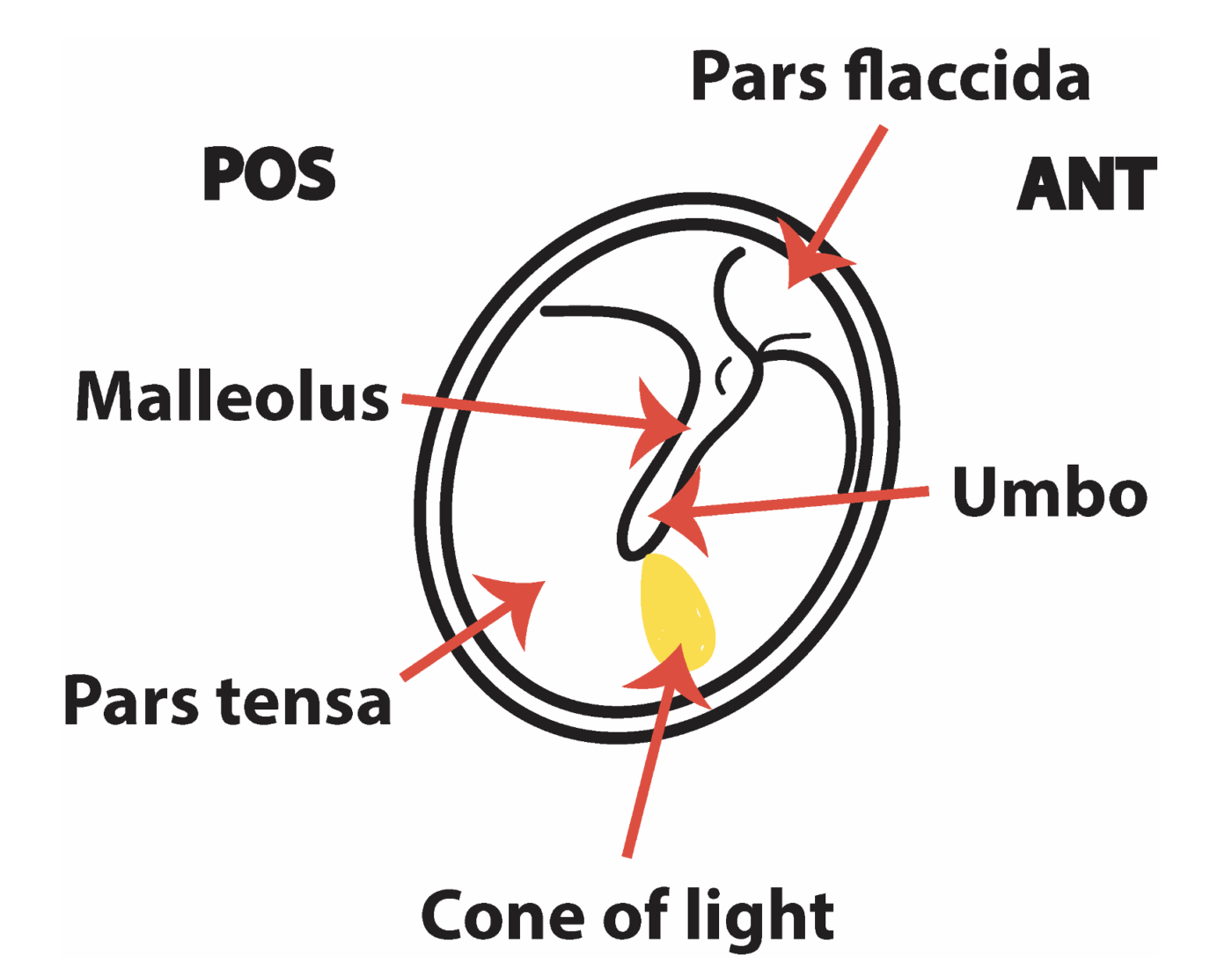 Ear examination OSCEstop OSCE Learning