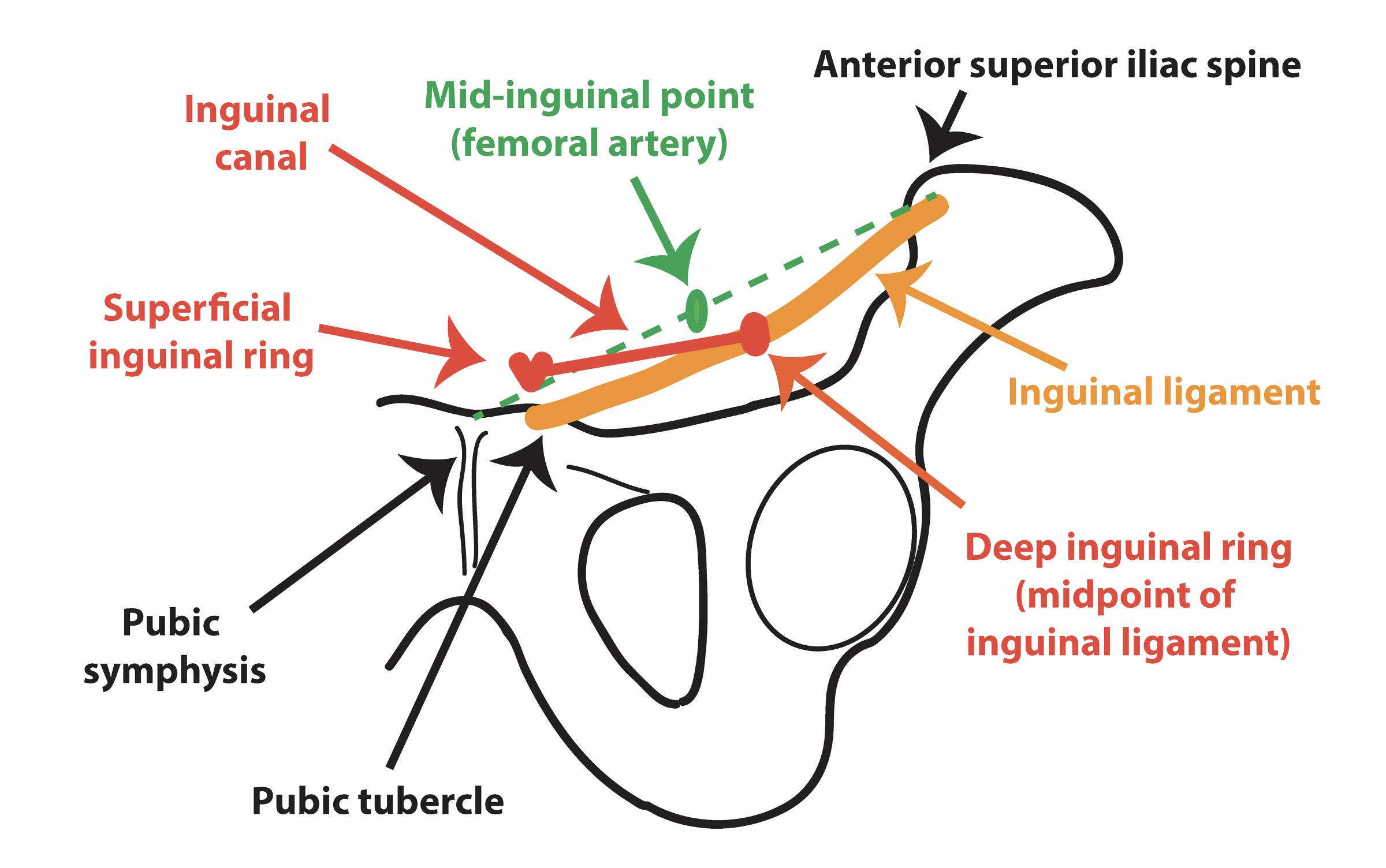 F1 Exposure of the Inguinal Canal and Spermatic Cord Structures |  SpringerLink