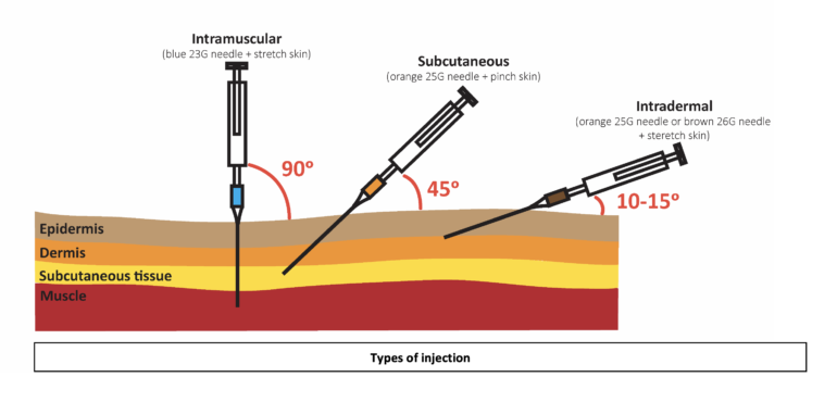 Subcutaneous Injection Oscestop Osce Learning