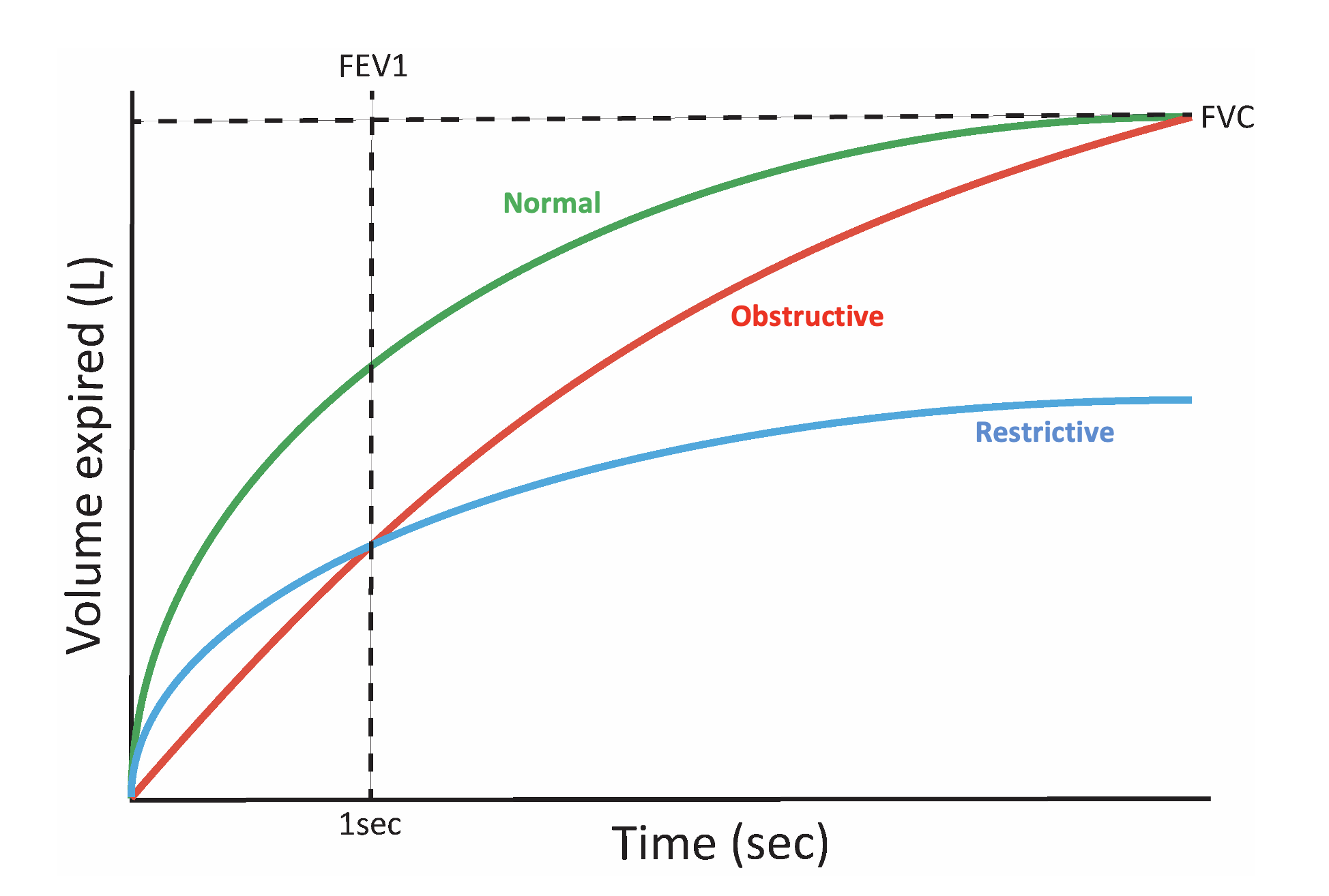Obstructive Vs Restrictive Lung Disease Spirometry