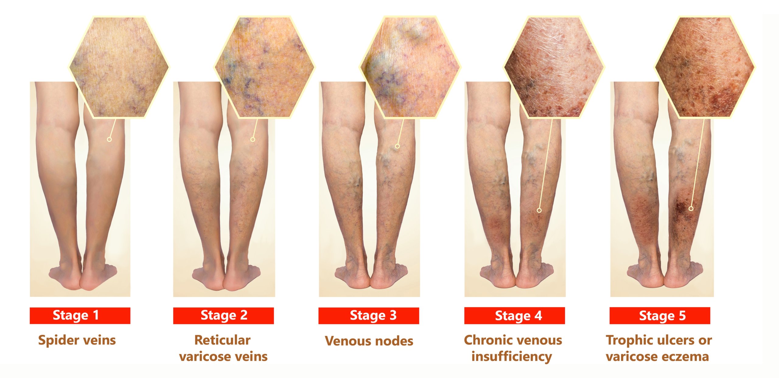 DVT Examination OSCEstop OSCE Learning