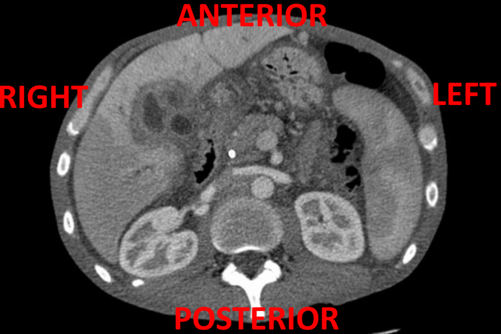 CT scan interpretation [advanced] OSCEstop