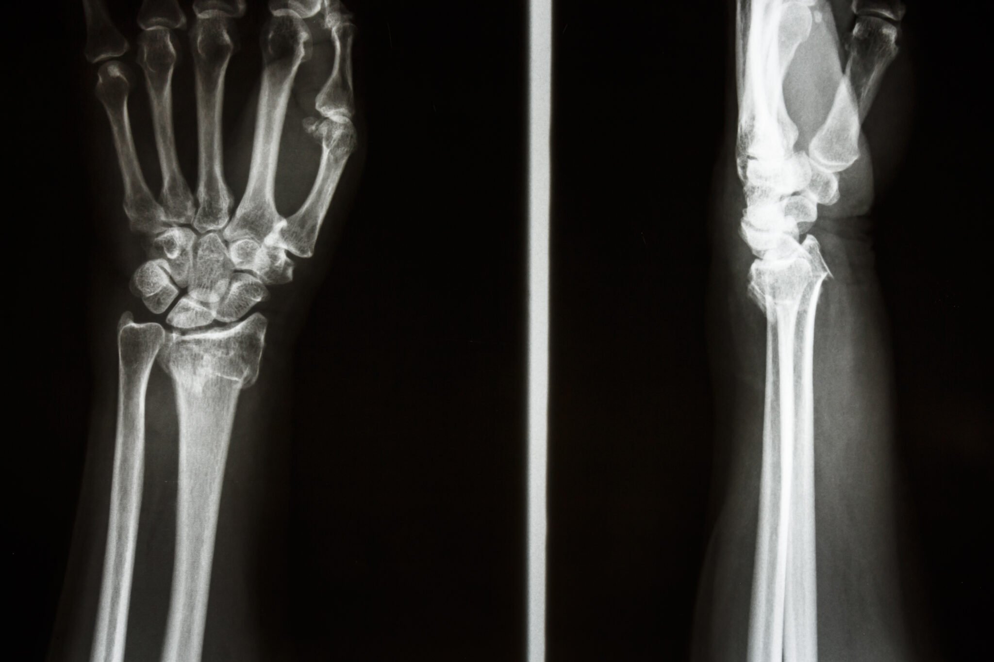 Musculoskeletal Radiograph Interpretation Generic Approach Oscestop